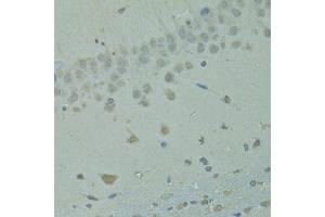 Immunohistochemistry of paraffin-embedded rat brain using IVNS1ABP antibody (ABIN1873334) at dilution of 1:100 (40x lens). (IVNS1ABP 抗体)