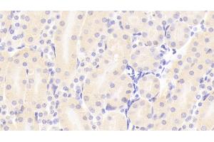 Detection of RBP4 in Mouse Kidney Tissue using Polyclonal Antibody to Retinol Binding Protein 4 (RBP4) (RBP4 抗体  (AA 63-245))