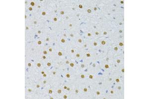 Immunohistochemistry of paraffin-embedded rat liver using SNRNP70 antibody (ABIN1877092) at dilution of 1:100 (40x lens). (SNRNP70 抗体)