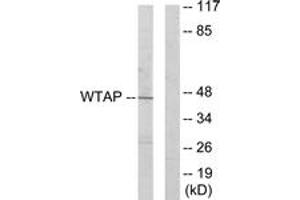 Western blot analysis of extracts from HuvEc cells, using WTAP Antibody. (WTAP 抗体  (AA 321-370))