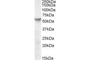 ABIN263185 (1µg/ml) staining of human cerebellum lysate (35µg protein in RIPA buffer). (CHRNB1 抗体  (Internal Region))