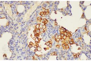 Immunohistochemistry of paraffin-embedded Rat lung using ANXA5 Ployclonal Antibody at dilution of 1:100. (Annexin V 抗体)