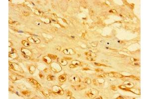 Immunohistochemistry of paraffin-embedded human placenta tissue using ABIN7157336 at dilution of 1:100