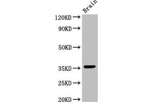 Western Blot Positive WB detected in: Mouse brain tissue All lanes: MNAT1 antibody at 3 μg/mL Secondary Goat polyclonal to rabbit IgG at 1/50000 dilution Predicted band size: 36, 32 kDa Observed band size: 36 kDa