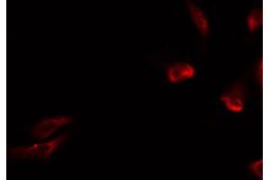 ABIN6274731 staining HeLa by IF/ICC. (MRPL15 抗体  (Internal Region))