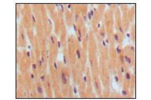 Immunohistochemical analysis of paraffin-embedded human normal myocardium, showing cytoplasmic localization using BNP1 mouse mAb with DAB staining. (BNP 抗体)