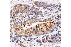 IHC analysis of EML4 using anti-EML4 antibody (ABIN6719384).