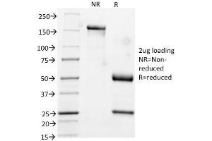 SDS-PAGE Analysis Purified CK17 Mouse Monoclonal Antibody (KRT17/778). (KRT17 抗体)