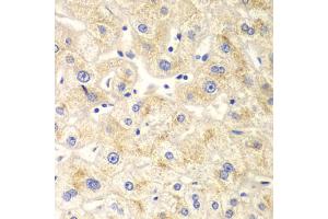 Immunohistochemistry of paraffin-embedded human liver injury using DNM1L antibody (ABIN5971410) at dilution of 1/100 (40x lens). (Dynamin 1-Like 抗体)