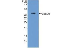 Detection of Recombinant PCX, Rat using Polyclonal Antibody to Podocalyxin (PODXL) (PODXL 抗体  (AA 153-386))