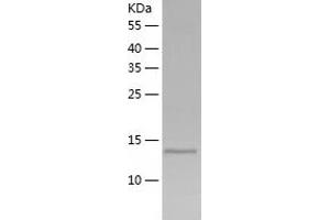Western Blotting (WB) image for Microtubule-Associated Protein 1 Light Chain 3 beta 2 (MAP1LC3B2) (AA 1-120) protein (His-IF2DI Tag) (ABIN7123961)