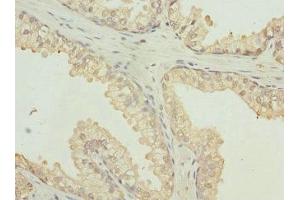 Immunohistochemistry (IHC) image for anti-Protein tyrosine Phosphatase, Receptor Type, B (PTPRB) (AA 1758-1997) antibody (ABIN7167501)