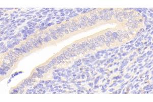 Detection of SCRN1 in Mouse Uterus Tissue using Polyclonal Antibody to Secernin 1 (SCRN1) (Secernin 1 抗体  (AA 2-414))