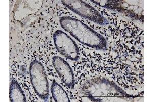 Image no. 1 for anti-RAB GTPase Activating Protein 1-Like (RABGAP1L) (AA 1-111) antibody (ABIN599499) (RABGAP1L 抗体  (AA 1-111))
