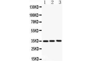 Anti- GM-CSF antibody, Western blotting All lanes: Anti GM-CSF  at 0. (GM-CSF 抗体  (Middle Region))