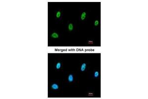 ICC/IF Image Immunofluorescence analysis of paraformaldehyde-fixed A549, using SESN3, antibody at 1:200 dilution. (SESN3 抗体)