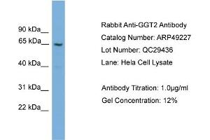 WB Suggested Anti-GGT2  Antibody Titration: 0. (gGT2 抗体  (N-Term))
