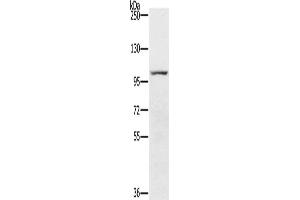 Gel: 6 % SDS-PAGE, Lysate: 40 μg, Lane: 293T cells, Primary antibody: ABIN7191822(PDE5A Antibody) at dilution 1/200, Secondary antibody: Goat anti rabbit IgG at 1/8000 dilution, Exposure time: 2 minutes (PDE5A 抗体)