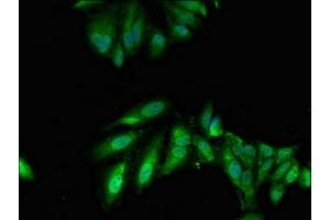 Immunofluorescent analysis of Hela cells using ABIN7173936 at dilution of 1:100 and Alexa Fluor 488-congugated AffiniPure Goat Anti-Rabbit IgG(H+L) (TWF1 抗体  (AA 199-252))