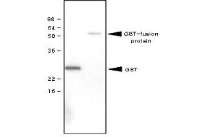 Western Blotting (WB) image for anti-Glutathione S Transferase (GST) antibody (ABIN165402) (GST 抗体)