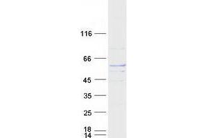 Western Blotting (WB) image for Tubulin, alpha 8 (TUBA8) protein (Myc-DYKDDDDK Tag) (ABIN2734547)