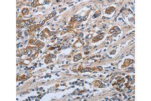 Immunohistochemistry (IHC) image for anti-Solute Carrier Family 34 (Sodium Phosphate), Member 2 (SLC34A2) antibody (ABIN2431831) (SLC34A2 抗体)
