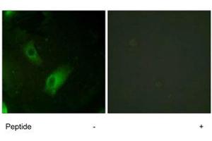 Immunofluorescence analysis of HeLa cells, using ACO1 polyclonal antibody .