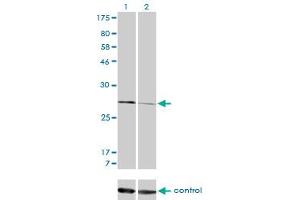Western blot analysis of CAPNS1 over-expressed 293 cell line, cotransfected with CAPNS1 Validated Chimera RNAi (Lane 2) or non-transfected control (Lane 1).