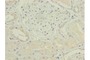 Immunohistochemistry (IHC) image for anti-Cyclin-dependent kinases regulatory subunit 2 (CKS2) (AA 2-79), (Regulatory Subunit 2) antibody (ABIN7148927)