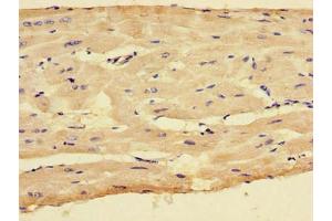 Immunohistochemistry of paraffin-embedded human heart tissue using ABIN7148772 at dilution of 1:100 (CX3CR1 抗体  (AA 298-351))