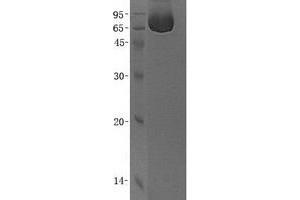 Western Blotting (WB) image for Annexin A6 (ANXA6) (Transcript Variant 1) protein (His tag) (ABIN2714745)
