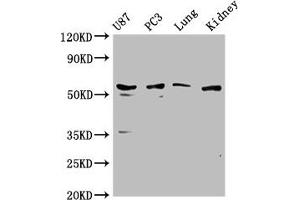 Western Blot Positive WB detected in: U87 whole cell lysate, PC3 whole cell lysate, Mouse lung tissue, Mouse kidney tissue All lanes: PPP5C antibody at 1:1000 Secondary Goat polyclonal to rabbit IgG at 1/50000 dilution Predicted band size: 57 kDa Observed band size: 57 kDa (PP5 抗体  (AA 370-488))