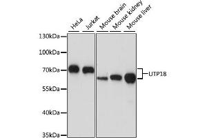 Western blot analysis of extracts of various cell lines, using UTP18 antibody. (UTP18 抗体)