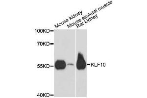 Western blot analysis of extracts of various cell lines, using KLF10 antibody. (KLF10/TIEG1 抗体  (AA 161-365))