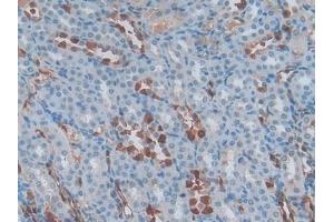 Detection of S100A6 in Rat Kidney Tissue using Polyclonal Antibody to S100 Calcium Binding Protein A6 (S100A6)