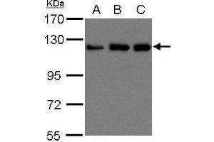 WB Image Sample (30 ug of whole cell lysate) A: 293T B: A431 , C: H1299 15% SDS PAGE antibody diluted at 1:1500
