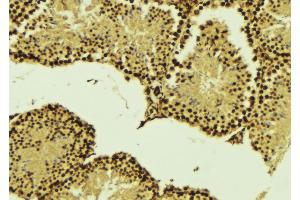 ABIN6268860 at 1/100 staining Mouse testis tissue by IHC-P. (Cyclin A1 抗体)