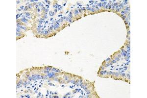 Immunohistochemistry of paraffin-embedded Mouse lung using STRN3 Polyclonal Antibody at dilution of 1:100 (40x lens). (STRN3 抗体)