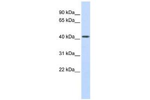 Carboxypeptidase B2 antibody used at 1 ug/ml to detect target protein. (CPB2 抗体)