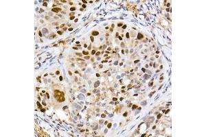 Immunohistochemistry (IHC) image for anti-DNA (Cytosine-5)-Methyltransferase 1 (DNMT1) antibody (ABIN7266808)
