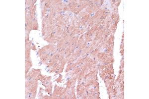 Immunohistochemistry of paraffin-embedded mouse heart using TIMM8B antibody (ABIN7270928) at dilution of 1:100 (40x lens).