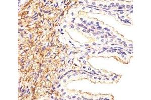 Immunohistochemical analysis of paraffin-embedded human prostate section using ATF6 beta antibody at 1:25.