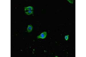 Immunofluorescent analysis of HepG2 cells using ABIN7153002 at dilution of 1:100 and Alexa Fluor 488-congugated AffiniPure Goat Anti-Rabbit IgG(H+L) (FNIP1 抗体  (AA 221-508))