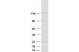 Western Blotting (WB) image for General Transcription Factor II I Repeat Domain-Containing 1 (GTF2IRD1) (Transcript Variant 2) protein (Myc-DYKDDDDK Tag) (ABIN2722323)