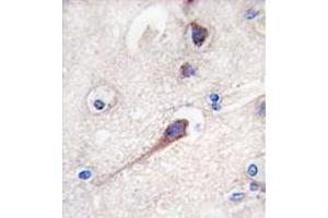 Image no. 3 for anti-Hippocalcin (HPCA) (N-Term) antibody (ABIN357112) (Hippocalcin 抗体  (N-Term))