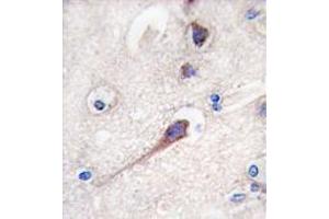 Image no. 3 for anti-Hippocalcin (HPCA) (N-Term) antibody (ABIN357112)