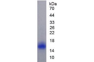 SDS-PAGE analysis of Rat Caveolin 1 Protein. (Caveolin-1 蛋白)