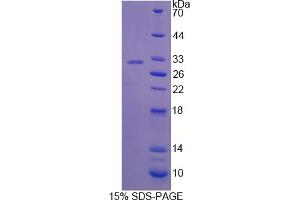 Image no. 1 for Interferon, gamma-Inducible Protein 30 (IFI30) (AA 1-250) protein (His tag) (ABIN4990294) (IFI30 Protein (AA 1-250) (His tag))