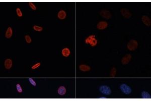 Immunofluorescence analysis of NIH/3T3 cells using Acetyl-Histone H2B-K15 Polyclonal Antibody at dilution of 1:100. (Histone H2B 抗体  (acLys15))