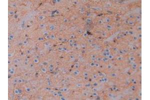 IHC-P analysis of Mouse Brain Tissue, with DAB staining. (Aquaporin 4 抗体  (AA 177-304))